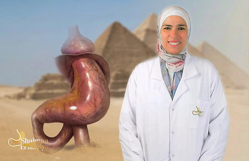 أفضل دكتور لعملية فتق الحجاب الحاجز في مصر